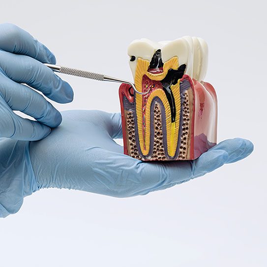 Knoxville Endodontics -